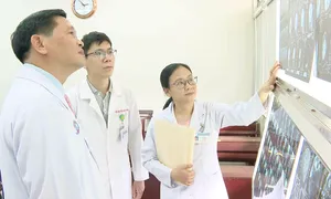 Mù hai mắt do biến chứng viêm xoang